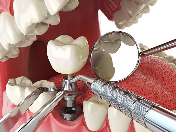 Best Urgent Tooth Repair  in Pike Creek Valley, DE